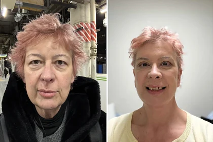 A 60-year-old woman who flew nearly 3,000 miles for a £10,000 facelift says trolls have been brutal about her swollen face as she recovers from the procedure.