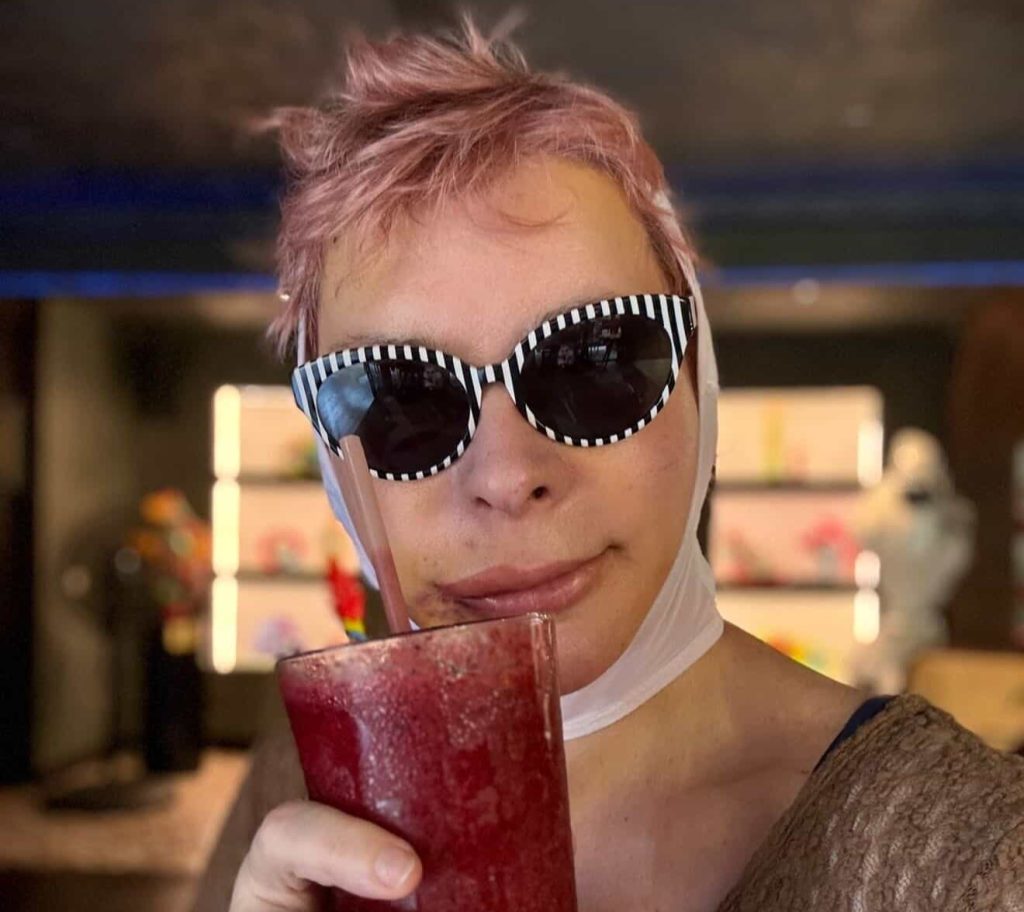 A 60-year-old woman who flew nearly 3,000 miles for a £10,000 facelift says trolls have been brutal about her swollen face as she recovers from the procedure.