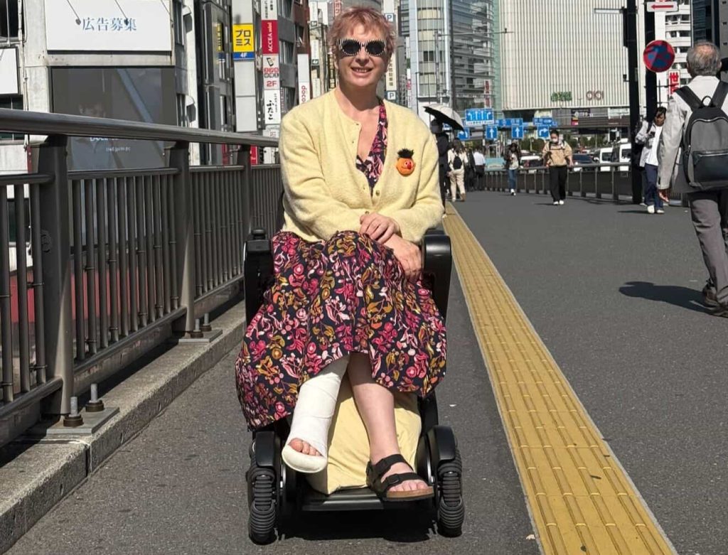 A 60-year-old woman who flew nearly 3,000 miles for a £10,000 facelift says trolls have been brutal about her swollen face as she recovers from the procedure.