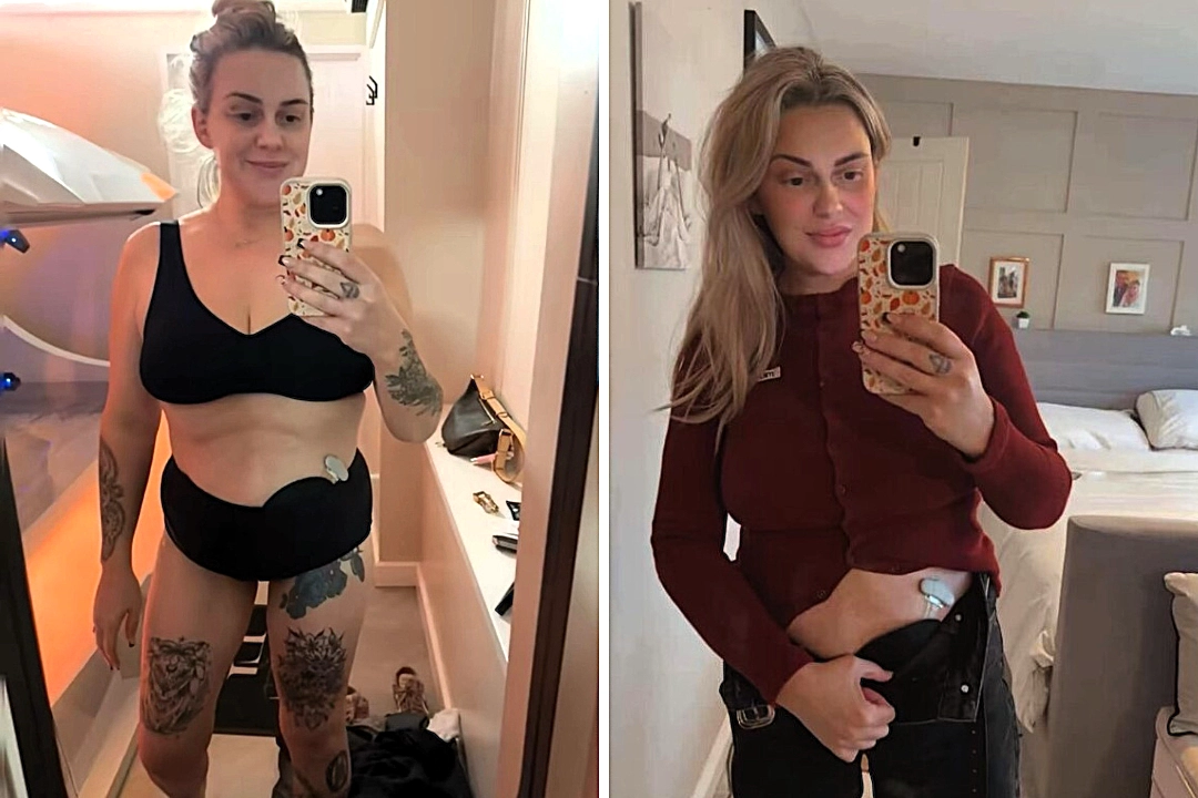 Mum Jenna Robinson lived in agony for eight years after a C-section side-effect left her with chronic constipation - until life-changing surgery finally ended her ordeal.