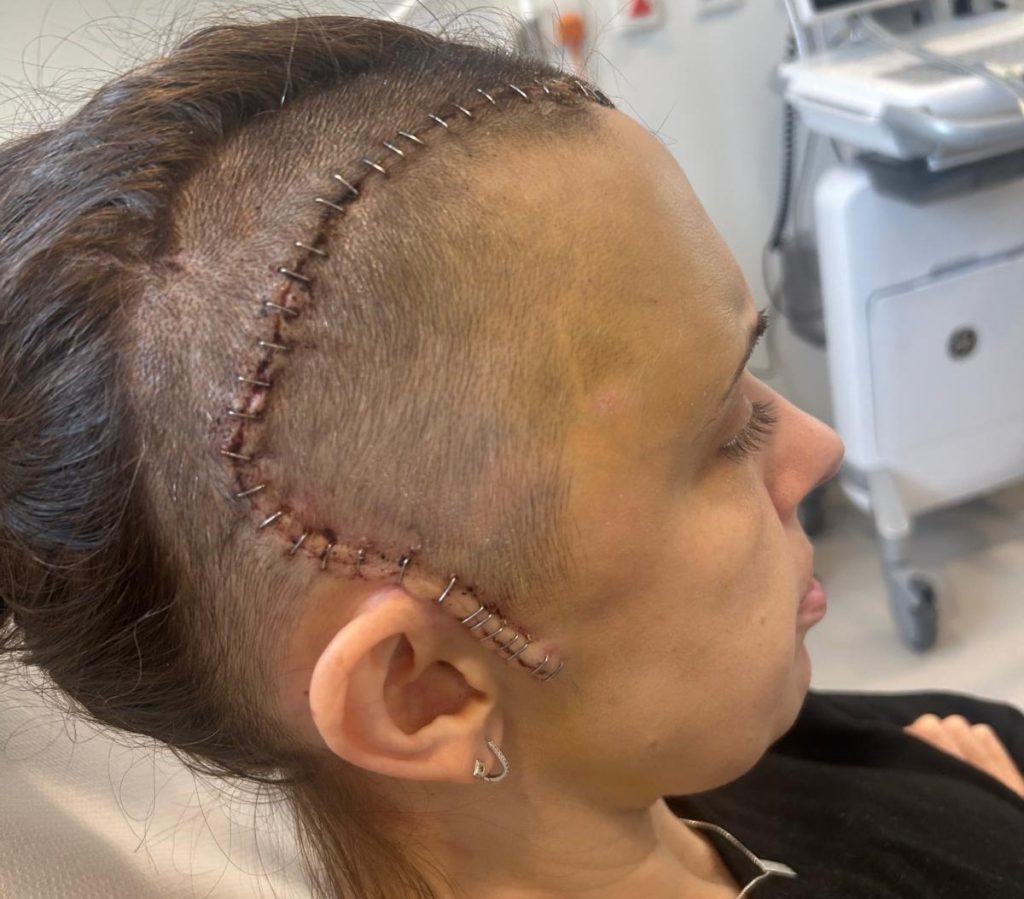 A mum diagnosed with a brain tumour who feared missing her children grow up says a groundbreaking new NHS drug has given her her future back.