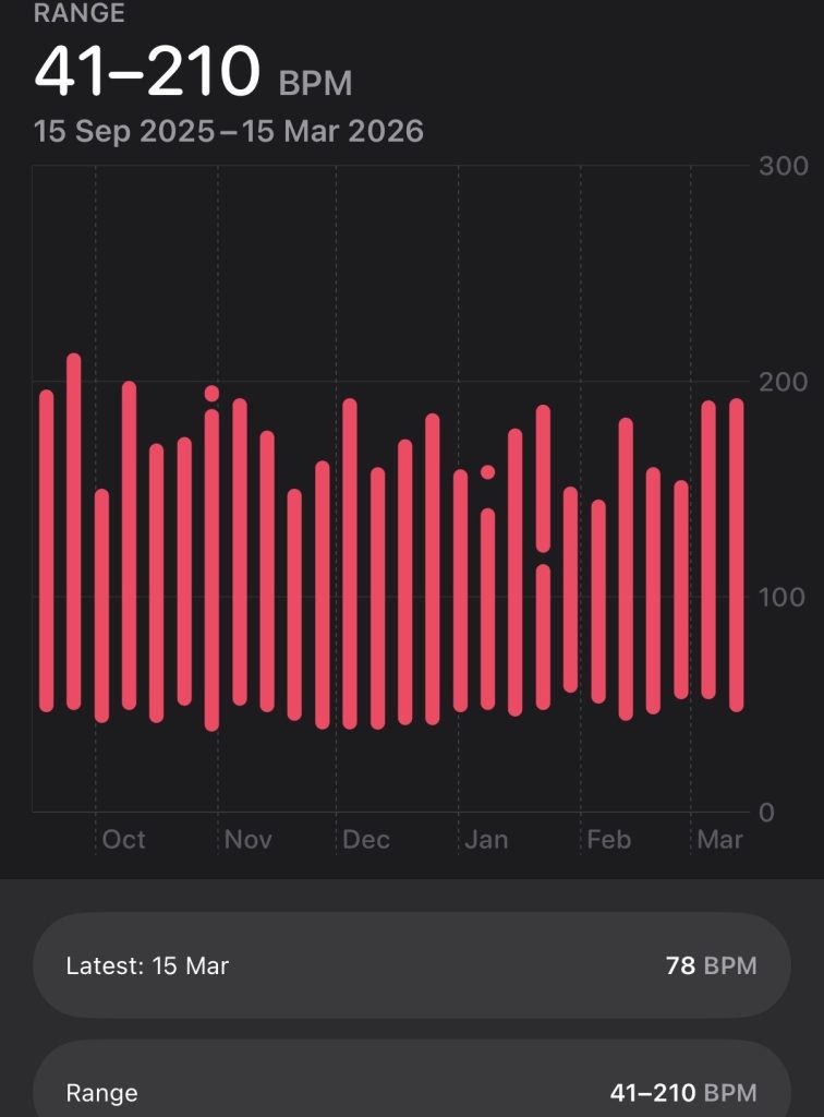 Woman diagnosed with serious heart condition after using a simple iPhone microphone hack she found on social media - a trick she says ultimately saved her life at just 21.