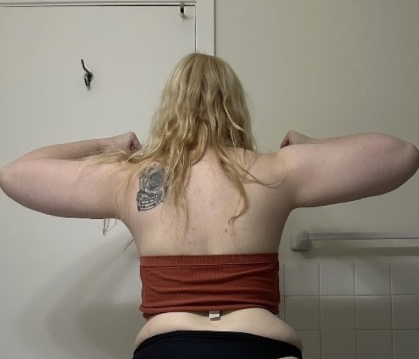 Mum Michelle Keith lost over 5 stone after discovering lipedema was behind her weight loss resistance - how anti-inflammatory eating and weight loss jabs changed her life.