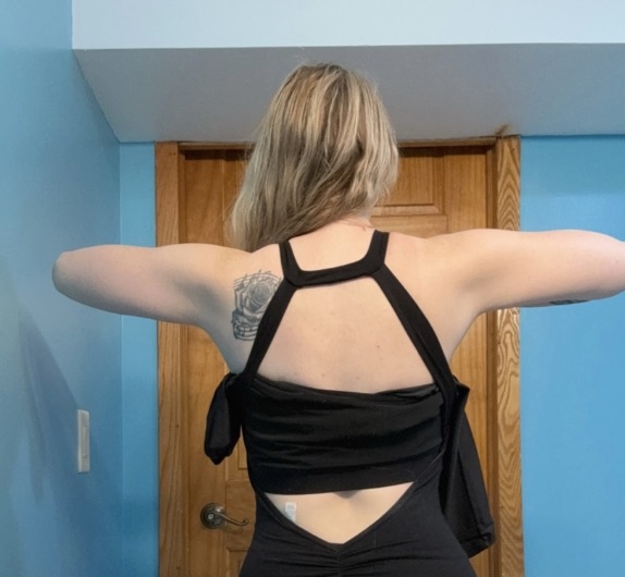 Mum Michelle Keith lost over 5 stone after discovering lipedema was behind her weight loss resistance - how anti-inflammatory eating and weight loss jabs changed her life.