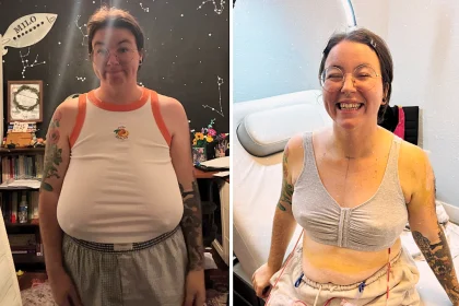 Mum Cameron Light spent £10,000 on a breast reduction removing 4.5lbs of tissue from her 40G chest - and says she could finally breathe the moment she woke from surgery.