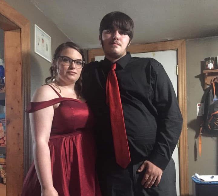 A woman's rescue pitbull ripped off her lips, cheek and nose while she had a seizure at home. Karma Davis now faces possible face transplant surgery but says she is glad to be alive.