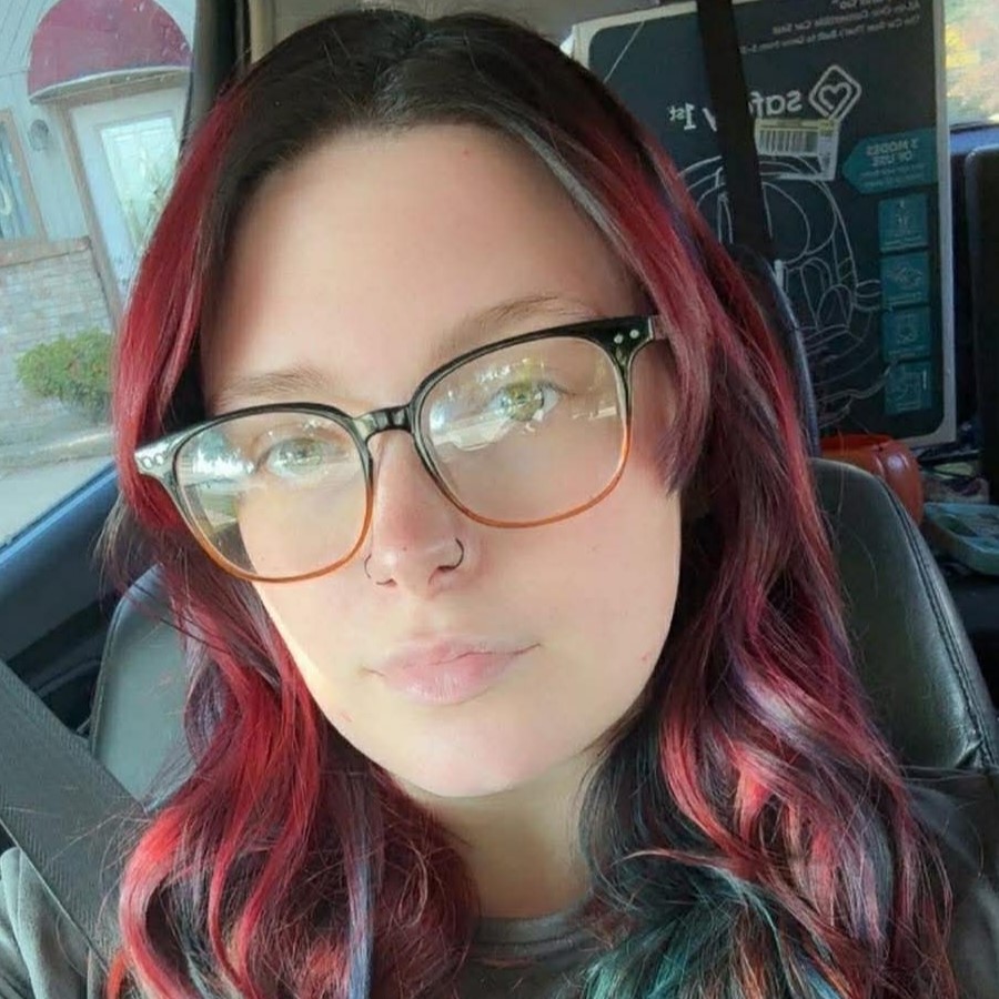 A woman's rescue pitbull ripped off her lips, cheek and nose while she had a seizure at home. Karma Davis now faces possible face transplant surgery but says she is glad to be alive.