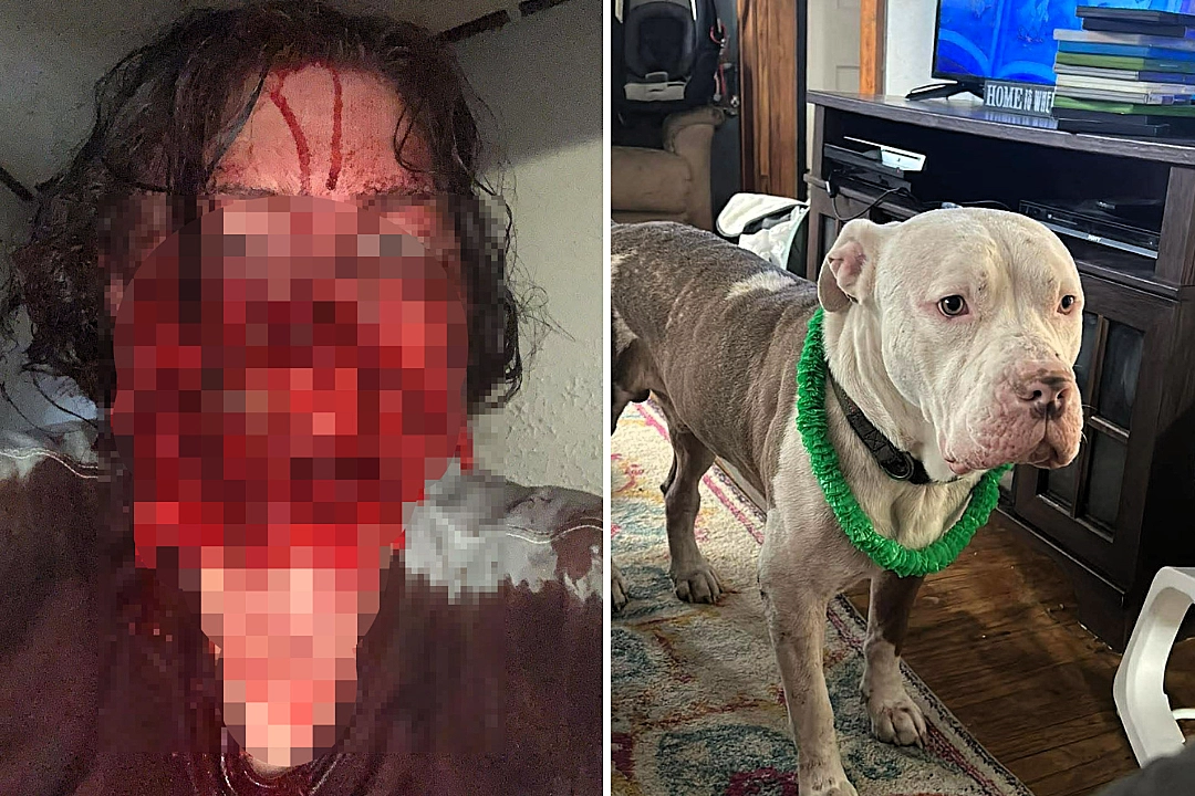 A woman's rescue pitbull ripped off her lips, cheek and nose while she had a seizure at home. Karma Davis now faces possible face transplant surgery but says she is glad to be alive.