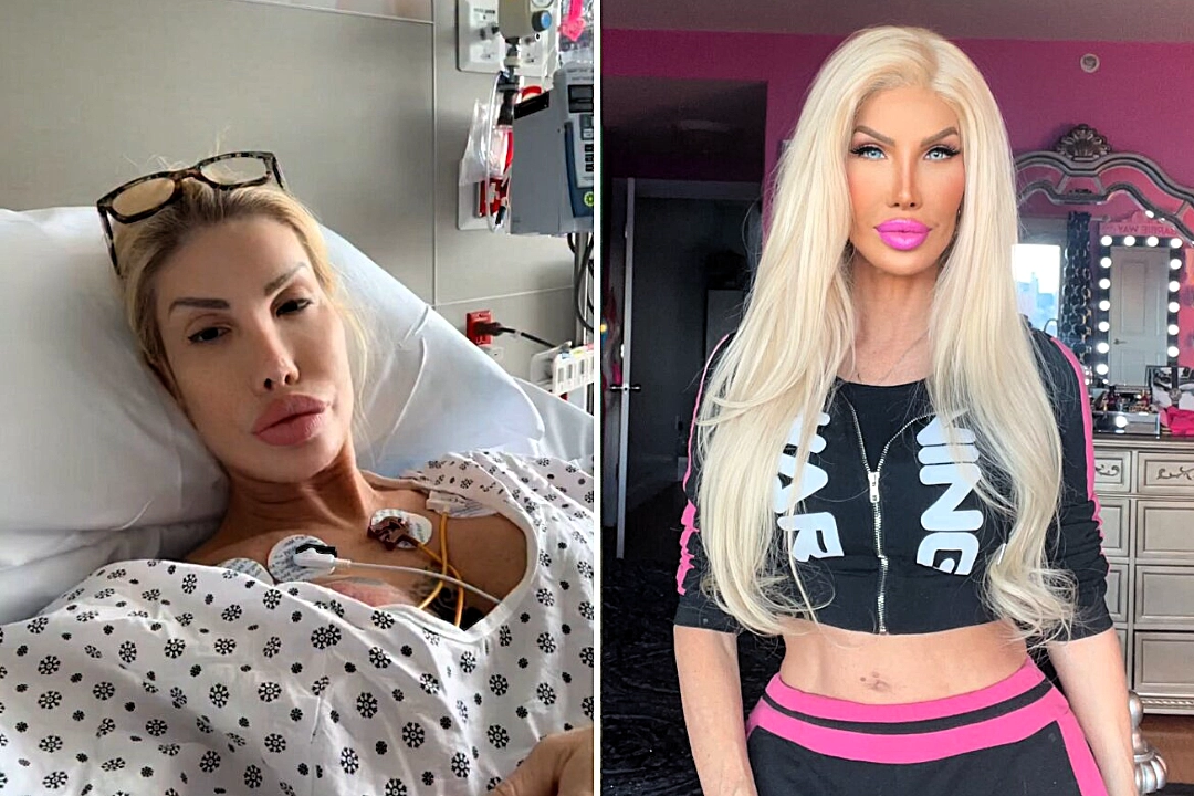 Reality star Nikki Exotika from 90 Day Fiancé underwent emergency quadruple bypass surgery after suffering a mild heart attack, with 25 medics involved.