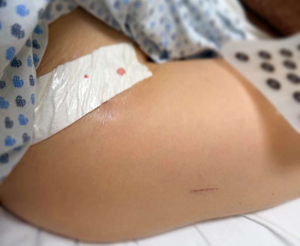 Former beauty queen and TNT Sports presenter Miroslava Montemayor, 36, reveals ultra-rare bone illness affecting just 22 Mexicans left her with 16 microfractures.