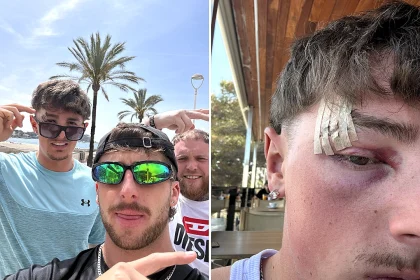 Brit left stranded on a lads holiday after a fractured eye socket and bruising on the brain stops him flying home - all thanks to his Lightning McQueen Crocs.