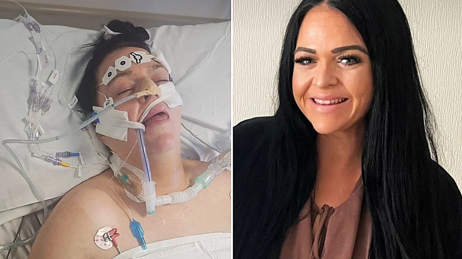 British mum of five fighting for life in induced coma in Gran Canaria after pneumonia and sepsis devastate her body as desperate husband begs for £15,000 to bring her home.