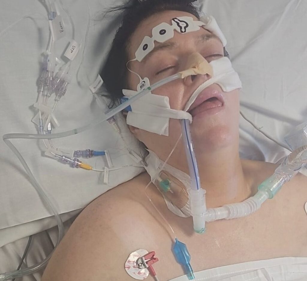 British mum of five fighting for life in induced coma in Gran Canaria after pneumonia and sepsis devastate her body as desperate husband begs for £15,000 to bring her home.