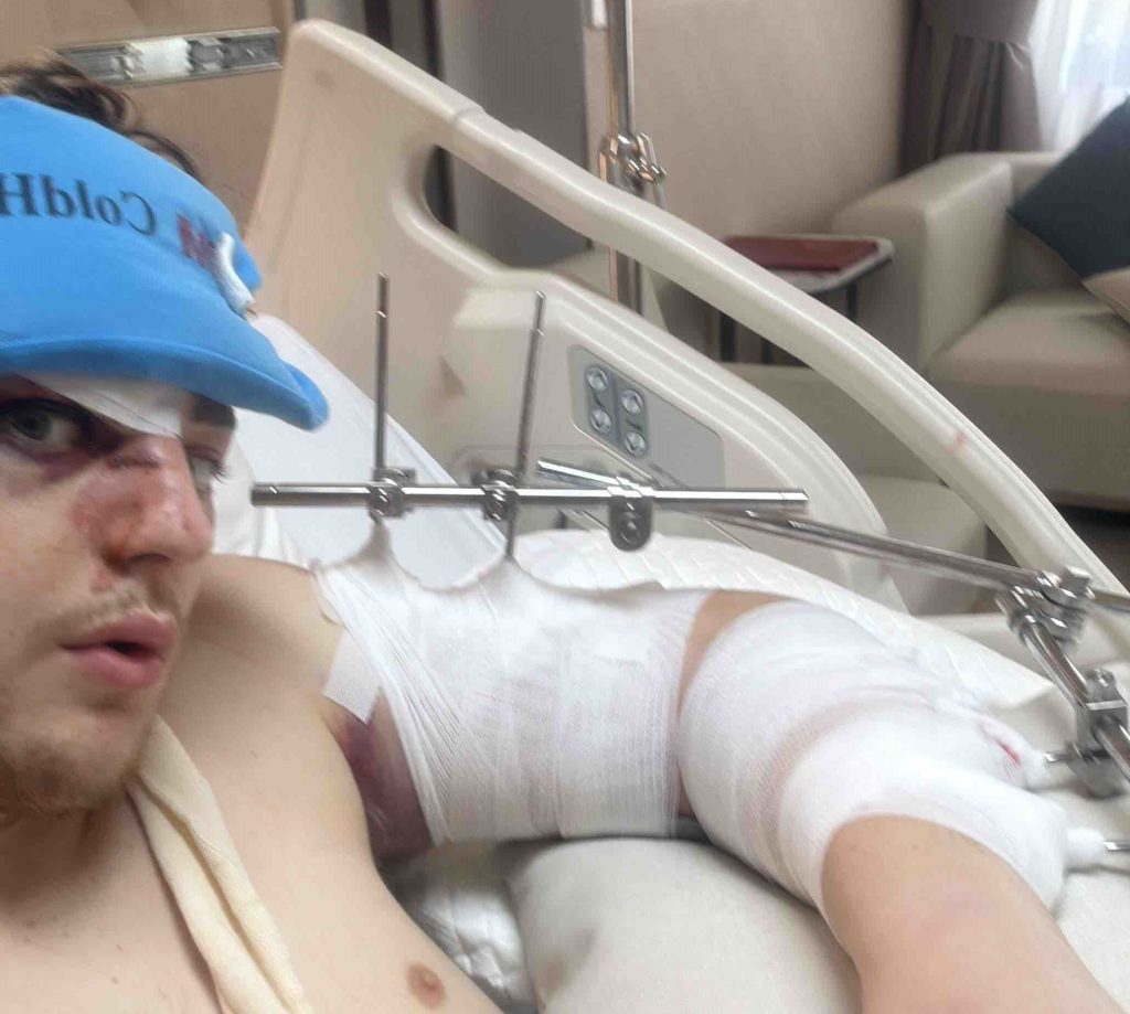 Brit suffers a horrific motorbike crash on a dream trip to Thailand and is launched into a parked car - leaving his family in a devastating 23,000 pound financial hole.