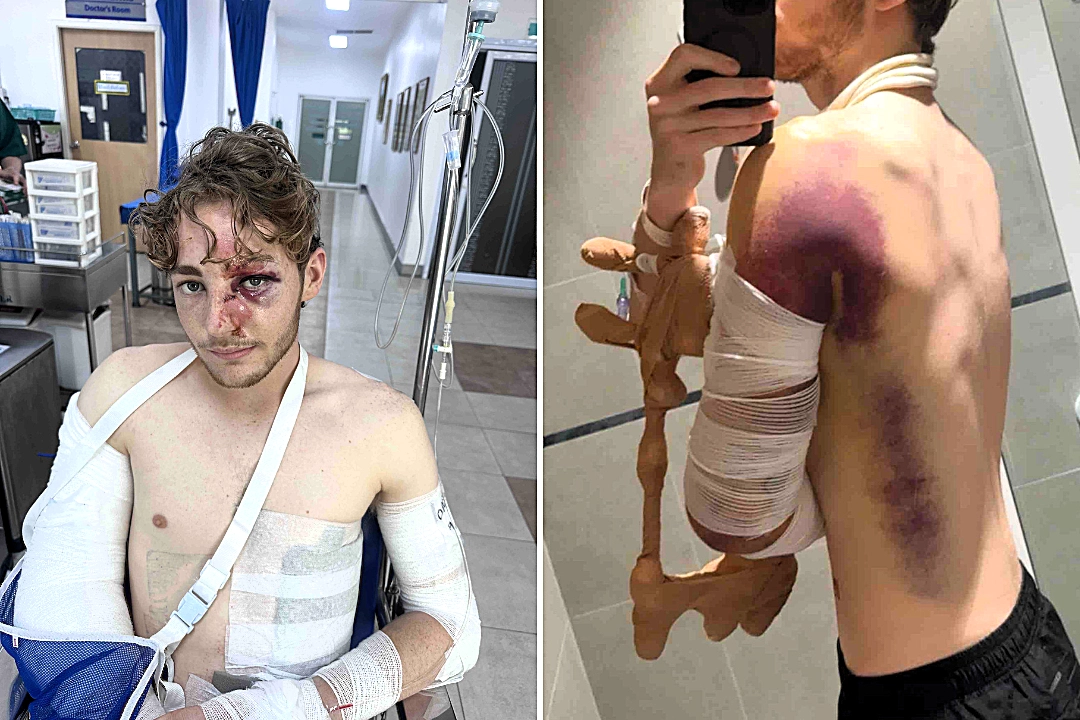 Brit suffers a horrific motorbike crash on a dream trip to Thailand and is launched into a parked car - leaving his family in a devastating 23,000 pound financial hole.