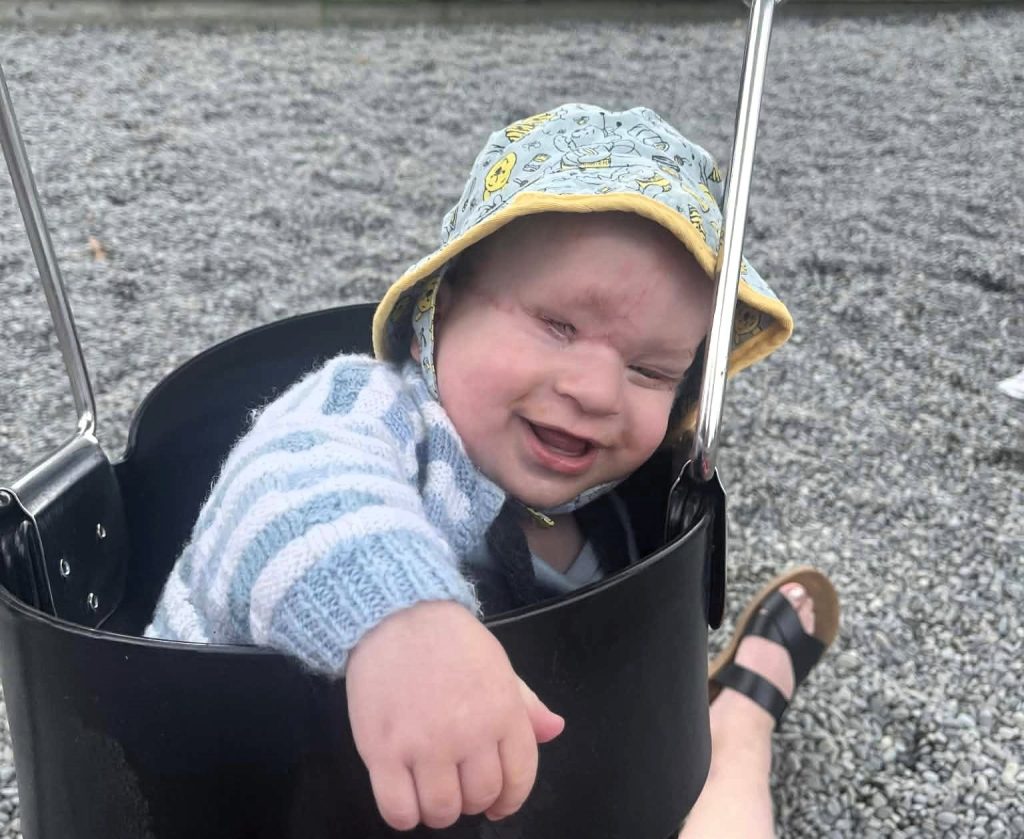 Mum's heartbreaking fears are confirmed when her baby is born with a band around his head - and doctors say the placenta is the greenest they have ever seen.