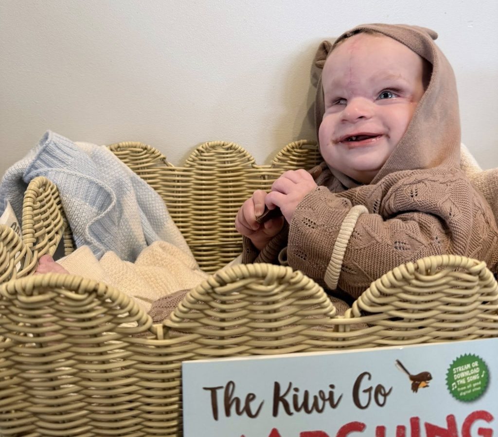 Mum's heartbreaking fears are confirmed when her baby is born with a band around his head - and doctors say the placenta is the greenest they have ever seen.