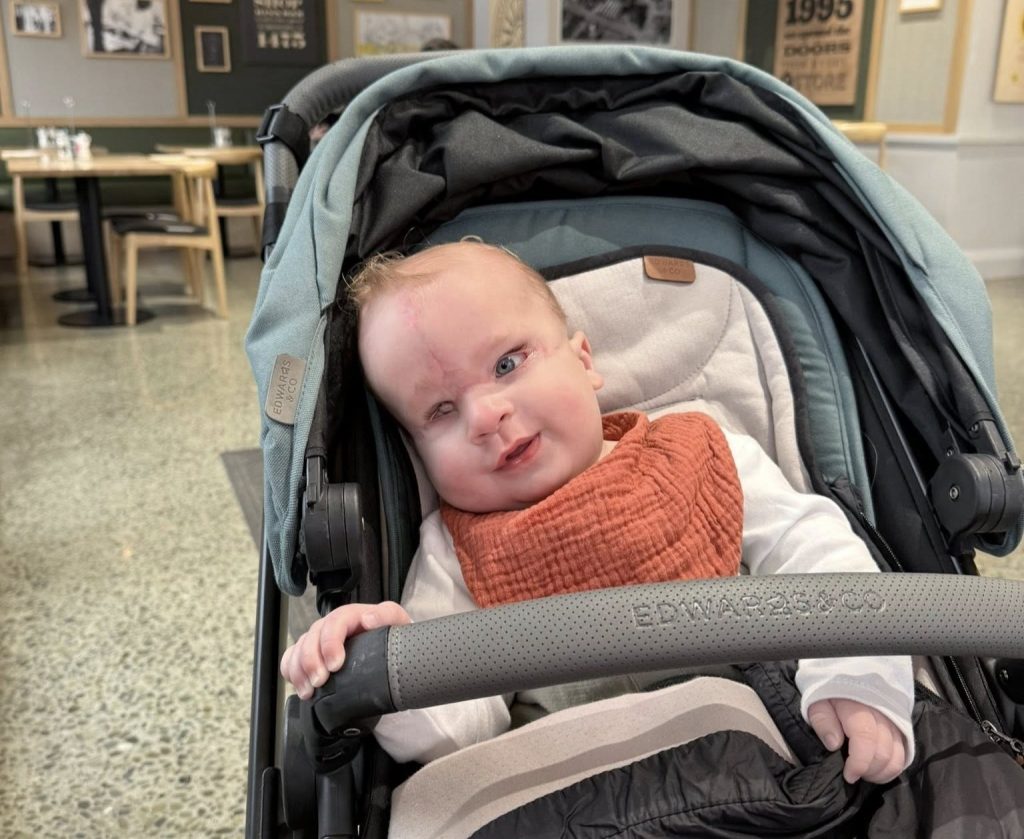 Mum's heartbreaking fears are confirmed when her baby is born with a band around his head - and doctors say the placenta is the greenest they have ever seen.