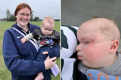 Mum's heartbreaking fears are confirmed when her baby is born with a band around his head - and doctors say the placenta is the greenest they have ever seen.