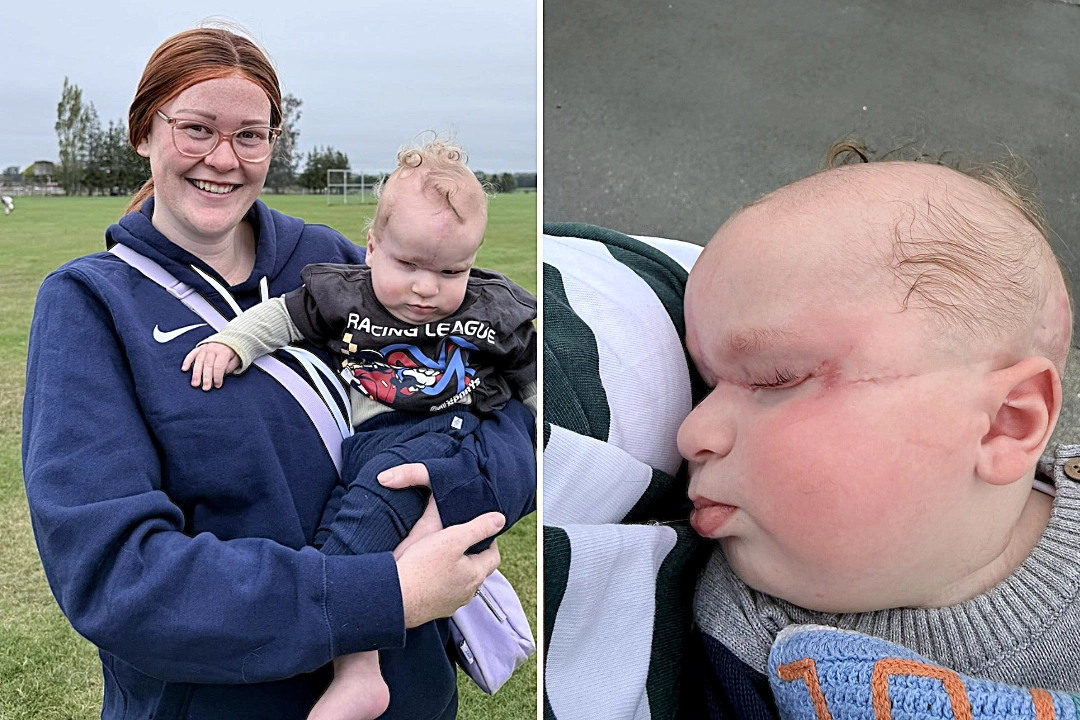 Mum's heartbreaking fears are confirmed when her baby is born with a band around his head - and doctors say the placenta is the greenest they have ever seen.