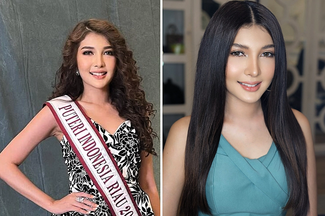 A former Indonesian beauty queen was arrested for allegedly posing as a cosmetic surgeon and permanently disfiguring patients at an unlicensed clinic she operated since 2019.