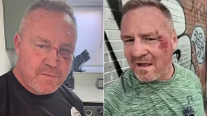 YouTuber Billy Moore suffered nasty faceplant injury after pothole flung him from scooter, then blasted Manchester mayor Andy Burnham over the city's road conditions.
