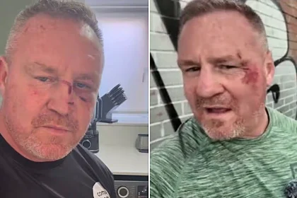 YouTuber Billy Moore suffered nasty faceplant injury after pothole flung him from scooter, then blasted Manchester mayor Andy Burnham over the city's road conditions.