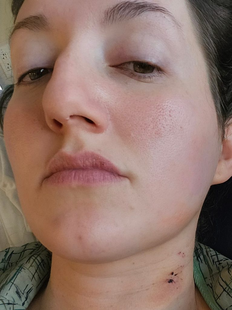 A mum's routine ectopic pregnancy surgery turned deadly when her heart stopped twice - find out how 28-year-old Hinda survived and came back to life.