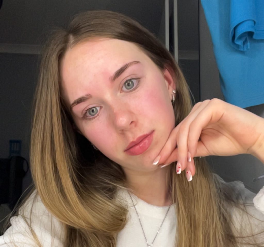 Childcare worker Mollie Lock, 18, thought she had flu - but ended up hospitalised with face swollen like a puffer fish after being struck down by glandular fever.