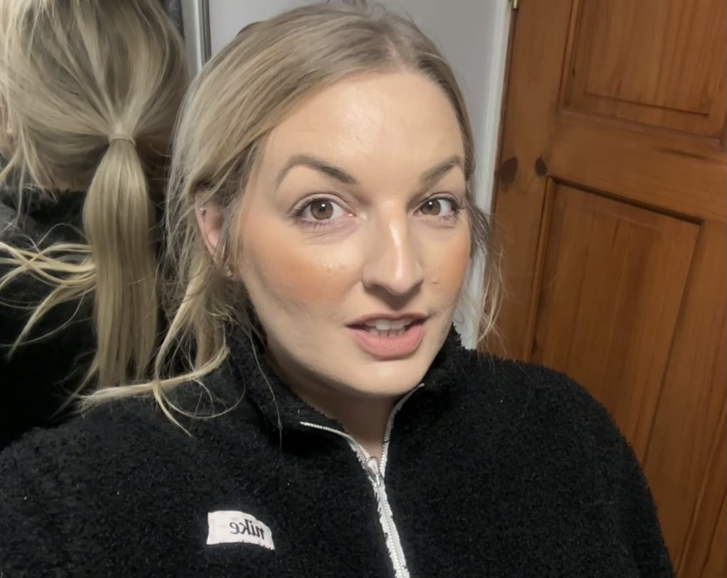 Woman speaks out about the horrifying reality of steroid cream usage - leaving her with agonisingly itchy burning skin that feels like she has been set on fire.