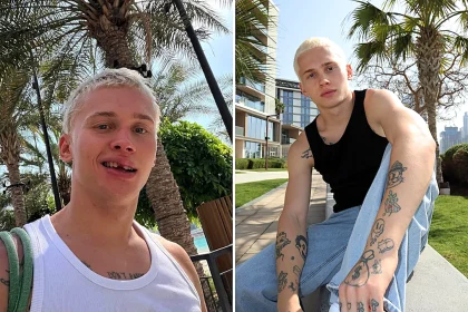 Influencer with over 20 million followers loses one of his front teeth after going down a children's slide at a swimming pool - and the embarrassing reason why.