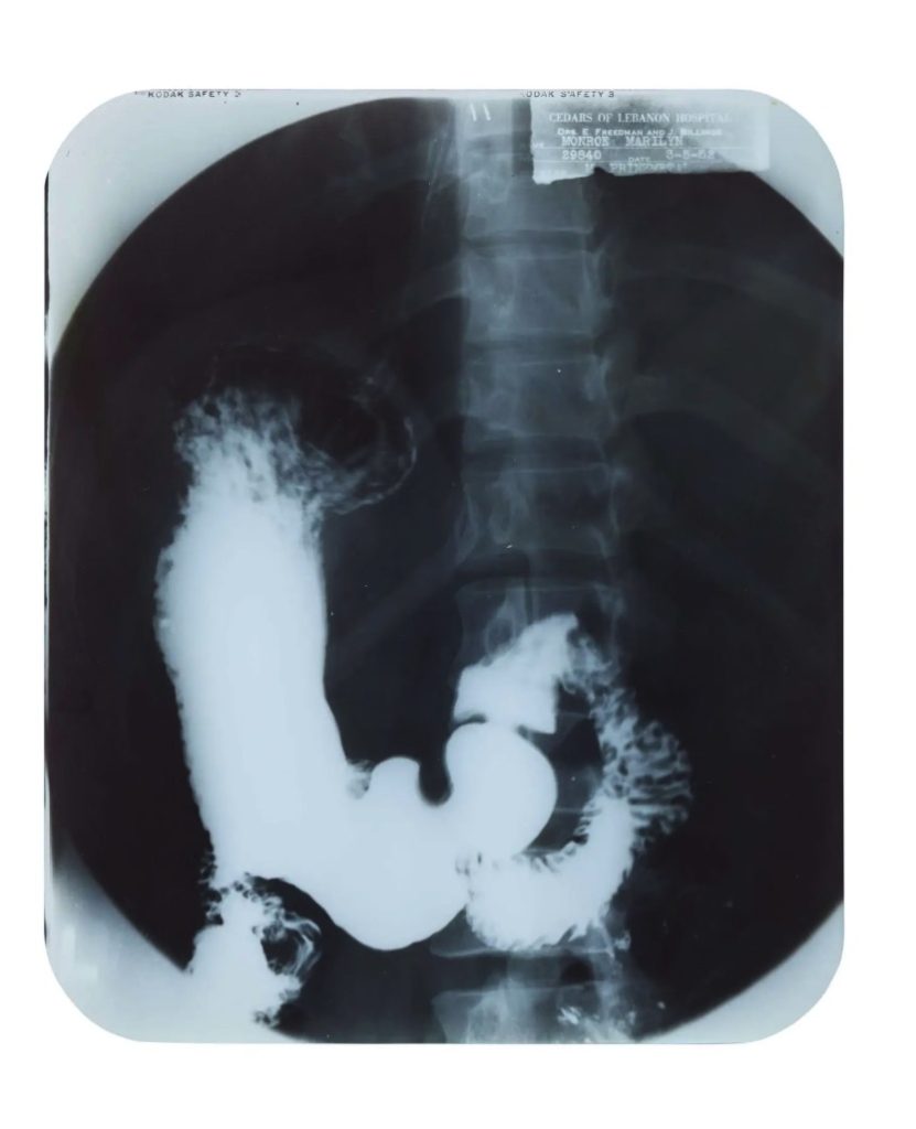 Marilyn Monroe's private medical x-rays from 1954 are heading to auction ahead of what would have been her 100th birthday, alongside a £148,000 gold evening purse from her collection.