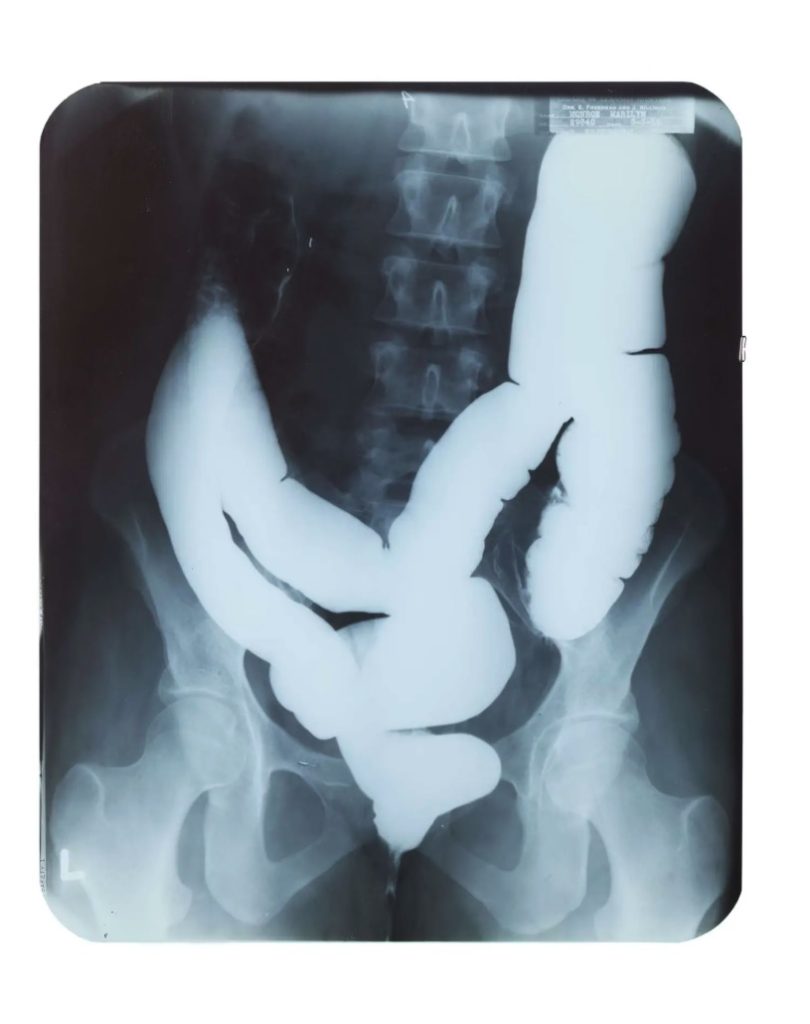 Marilyn Monroe's private medical x-rays from 1954 are heading to auction ahead of what would have been her 100th birthday, alongside a £148,000 gold evening purse from her collection.