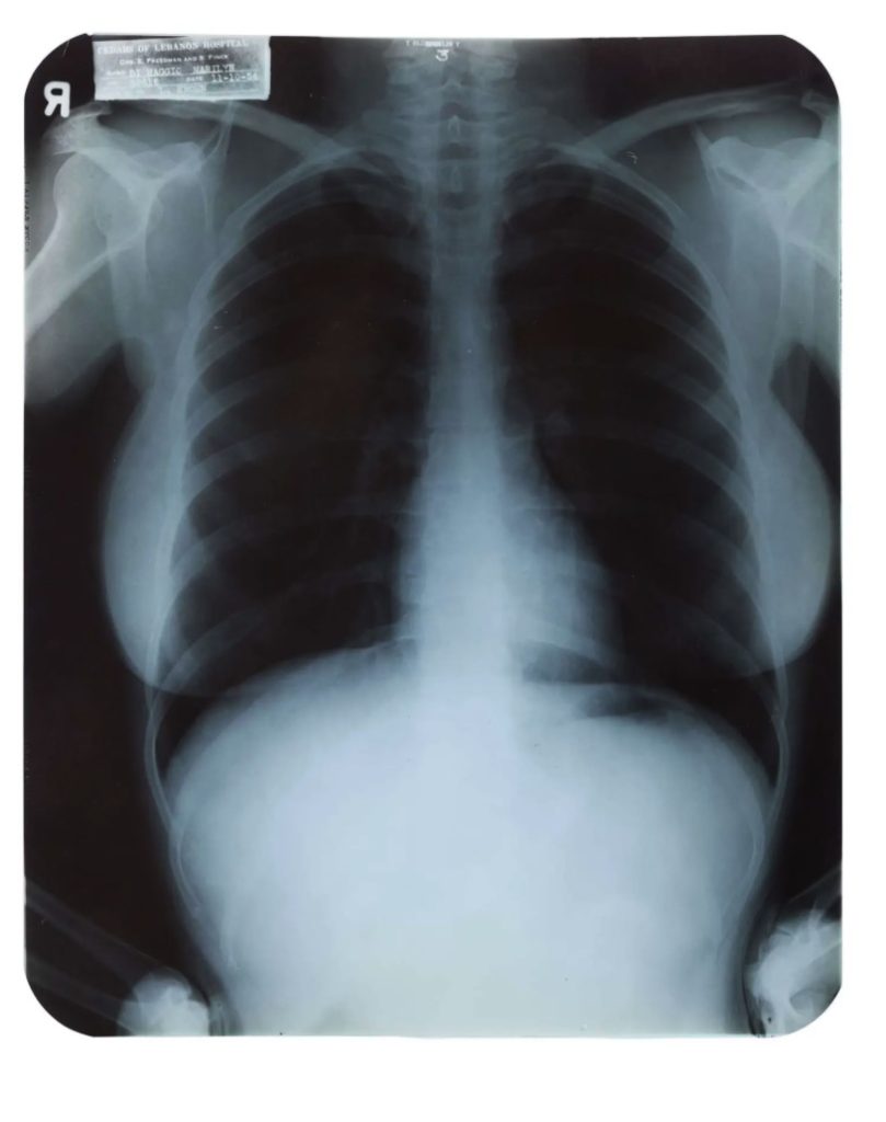 Marilyn Monroe's private medical x-rays from 1954 are heading to auction ahead of what would have been her 100th birthday, alongside a £148,000 gold evening purse from her collection.