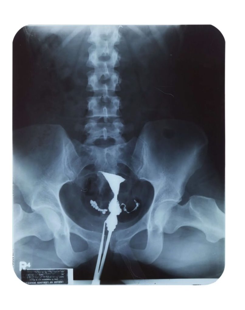 Marilyn Monroe's private medical x-rays from 1954 are heading to auction ahead of what would have been her 100th birthday, alongside a £148,000 gold evening purse from her collection.
