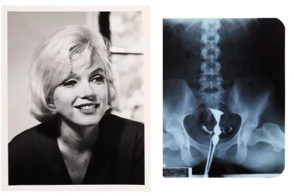 Marilyn Monroe's private medical x-rays from 1954 are heading to auction ahead of what would have been her 100th birthday, alongside a £148,000 gold evening purse from her collection.