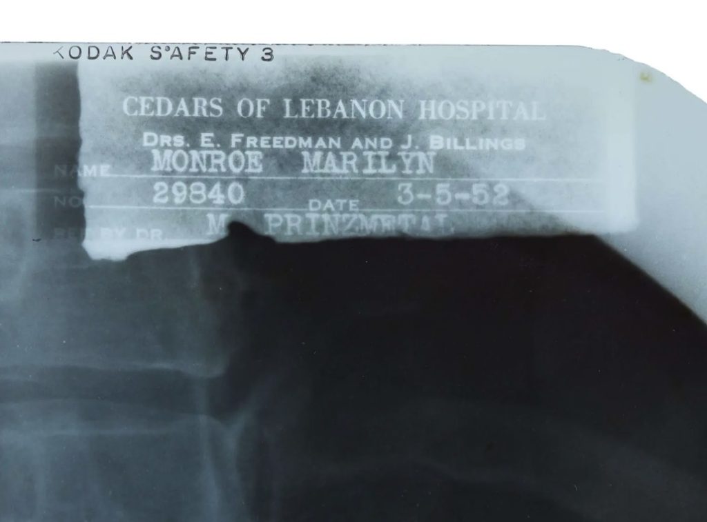 Marilyn Monroe's private medical x-rays from 1954 are heading to auction ahead of what would have been her 100th birthday, alongside a £148,000 gold evening purse from her collection.