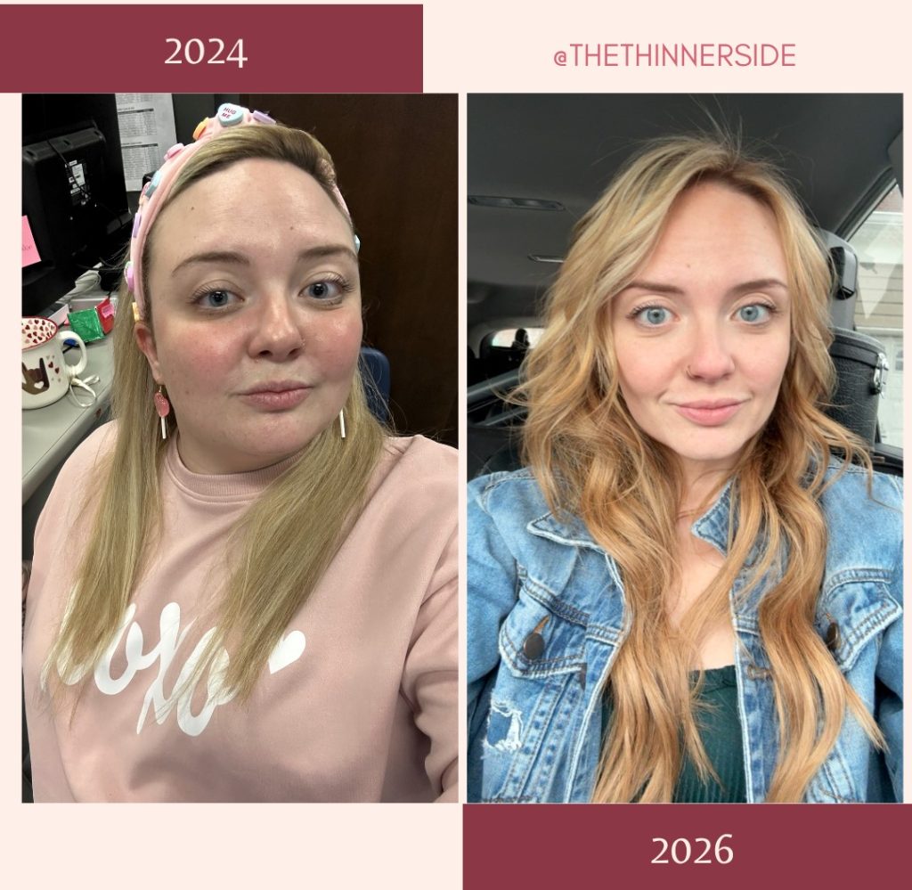 A teacher who avoided smiling due to her chubby cheeks and double chin reveals how Mounjaro helped her lose 140lbs - transforming her face and confidence forever.