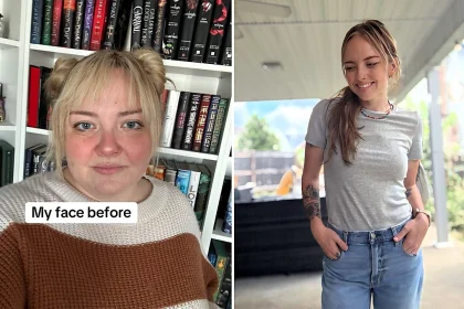 A teacher who avoided smiling due to her chubby cheeks and double chin reveals how Mounjaro helped her lose 140lbs - transforming her face and confidence forever.