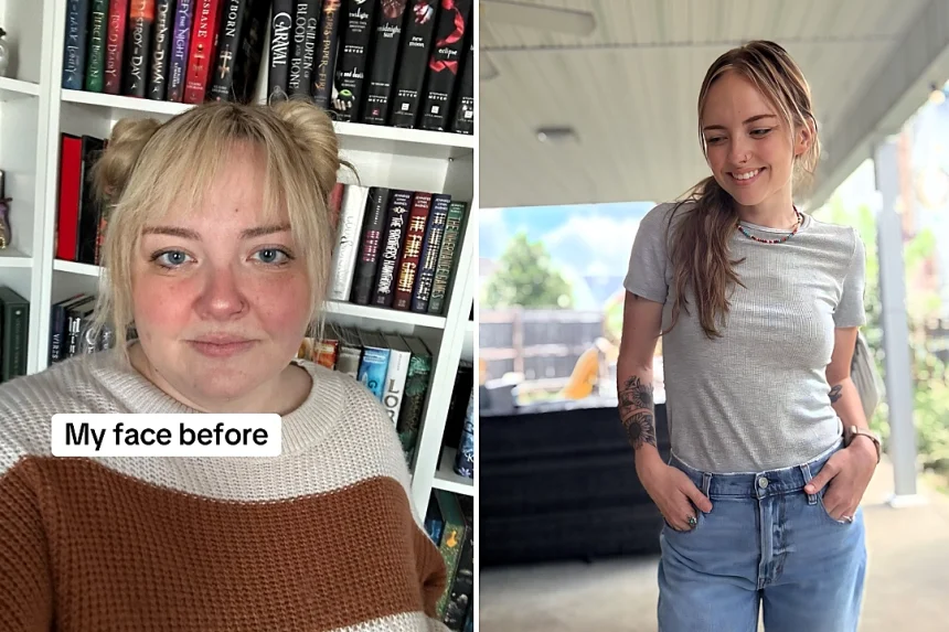 A teacher who avoided smiling due to her chubby cheeks and double chin reveals how Mounjaro helped her lose 140lbs - transforming her face and confidence forever.