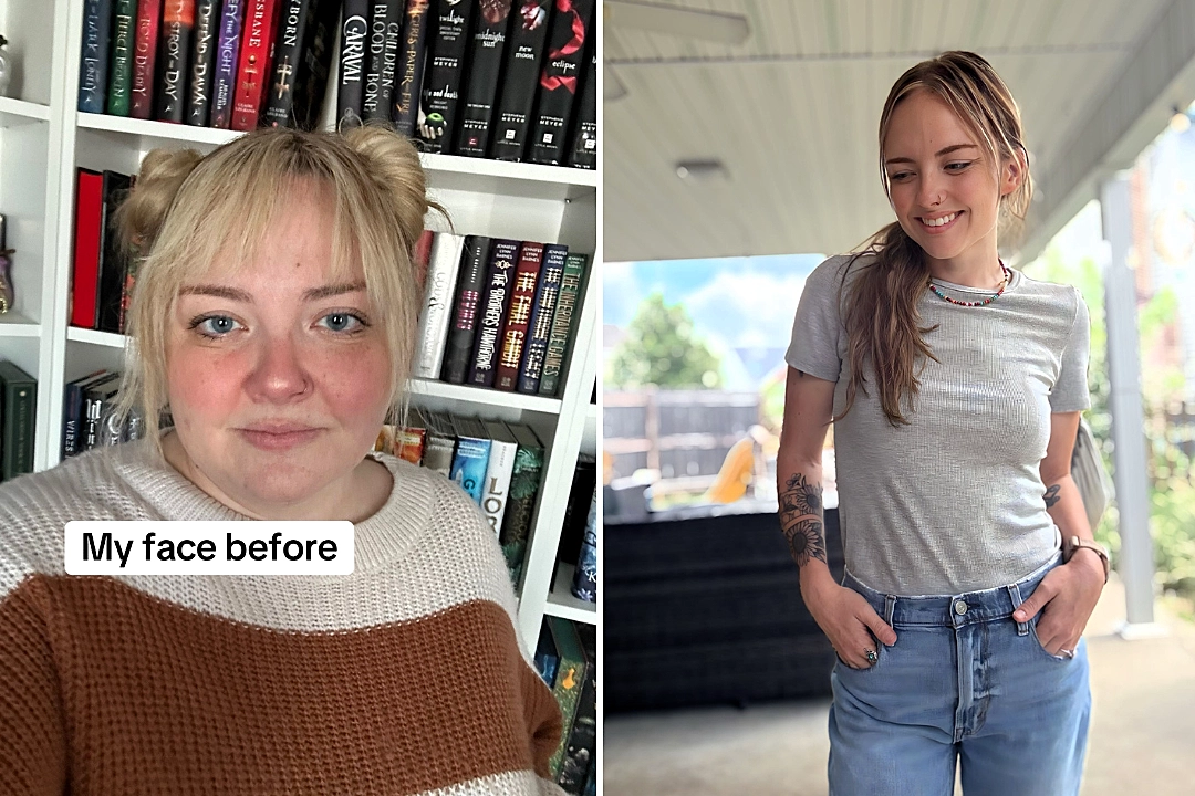 A teacher who avoided smiling due to her chubby cheeks and double chin reveals how Mounjaro helped her lose 140lbs - transforming her face and confidence forever.