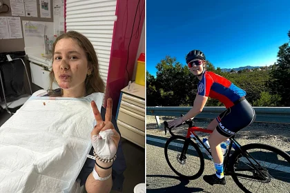Pro cyclist Kamilla Aasebø, 19, has shared her shocking scar after a Paris-Roubaix crash left her with a brain bleed that required emergency surgery and left her fighting to walk.