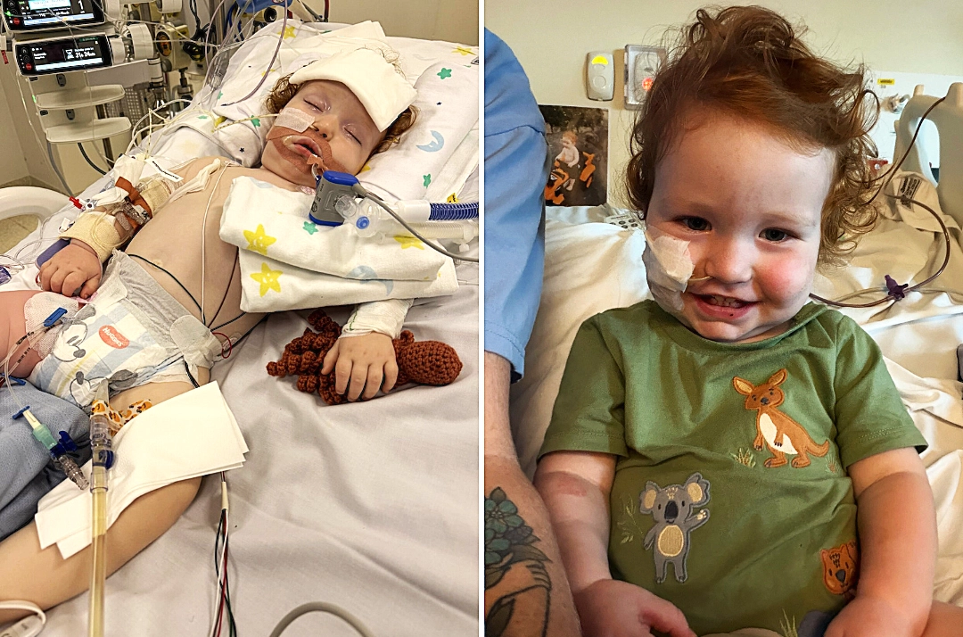 Toddler who nearly died after inhaling cake decorating dust during his birthday cake nightmare is finally awake, smiling and breathing on his own again.
