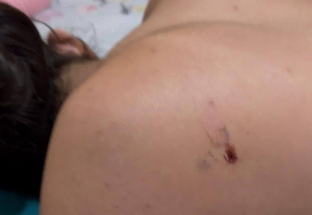 Woman, 24, dies in intensive care after botched liposuction op allegedly punctured her lung, leaving young daughter behind as devastated husband demands justice.