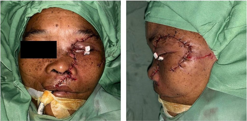 Woman has half her face ripped off by a bear in a horrific attack while working on a coffee plantation - and is dragged 10 metres along the ground.