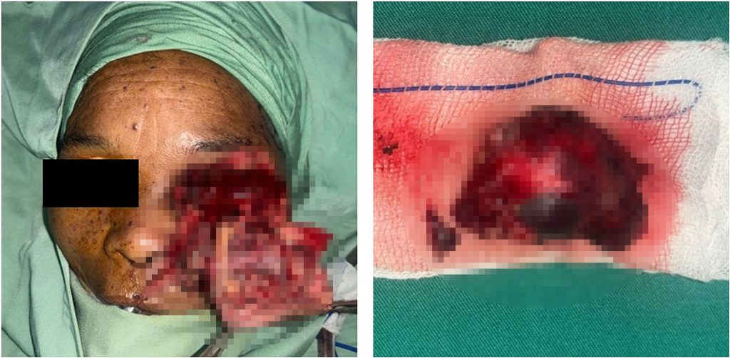 Woman has half her face ripped off by a bear in a horrific attack while working on a coffee plantation - and is dragged 10 metres along the ground.