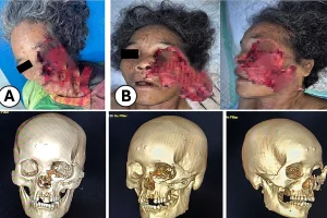Woman has half her face ripped off by a bear in a horrific attack while working on a coffee plantation - and is dragged 10 metres along the ground.