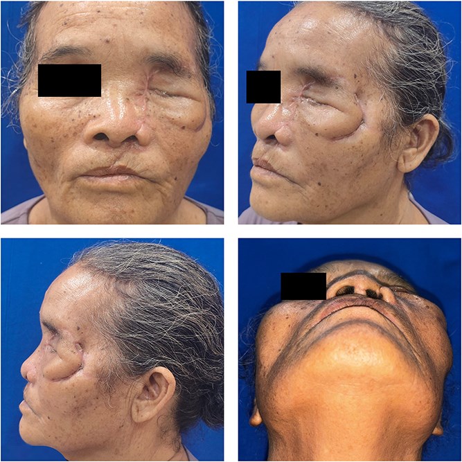 Woman has half her face ripped off by a bear in a horrific attack while working on a coffee plantation - and is dragged 10 metres along the ground.