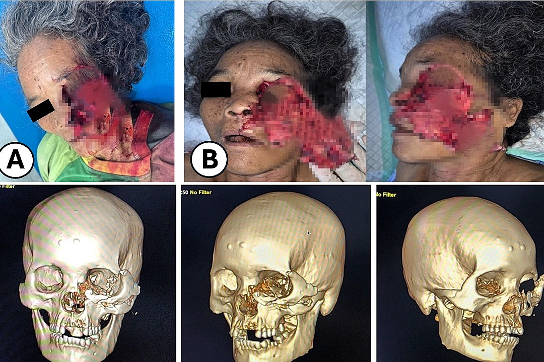 Woman has half her face ripped off by a bear in a horrific attack while working on a coffee plantation - and is dragged 10 metres along the ground.
