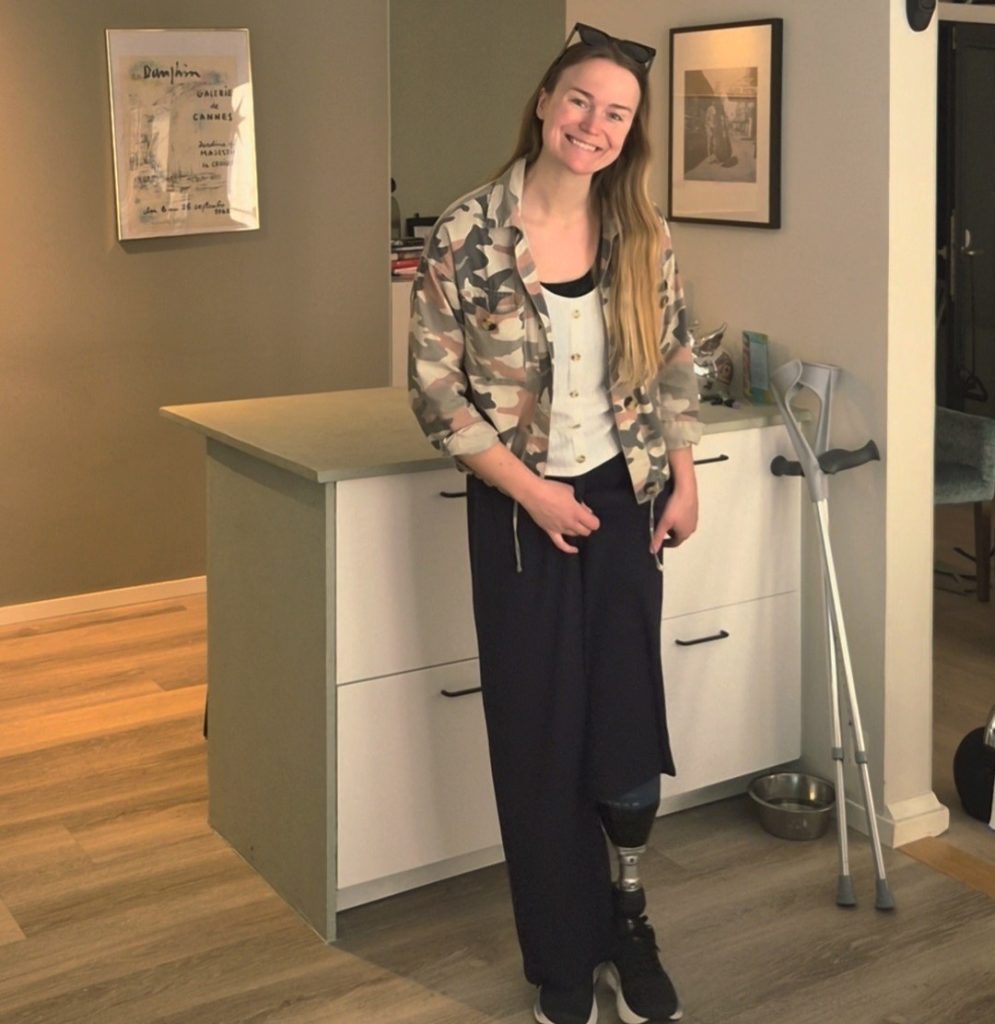 Swedish woman becomes the first person in the country to undergo a groundbreaking amputation - and says she can already feel her missing foot moving again.